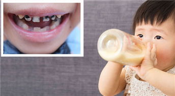 乳牙期口腔护理的重要性 别让疏忽影响恒牙健康